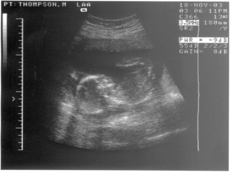 Scan 2