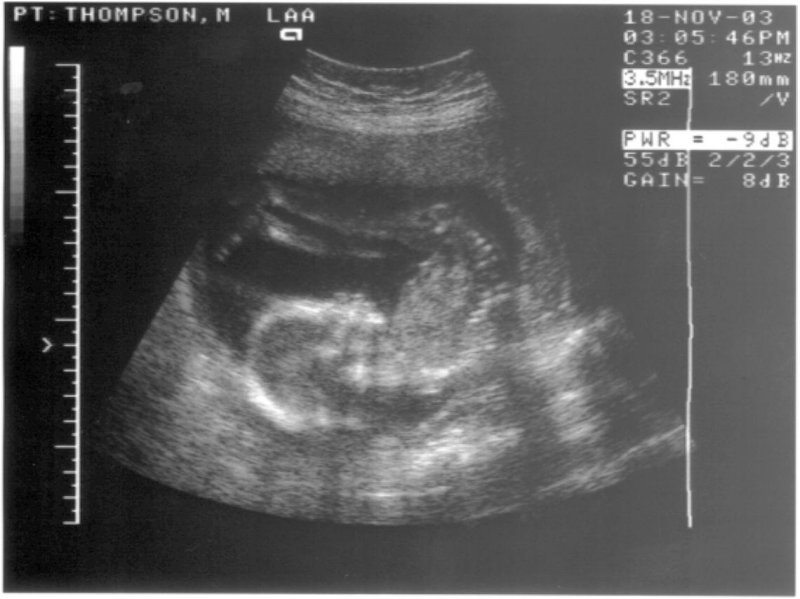 Scan 3